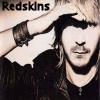 Redskins